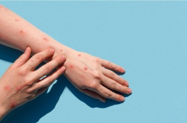 ED9849A8-B0DE-4AA4-A403-0C85EDB306D2